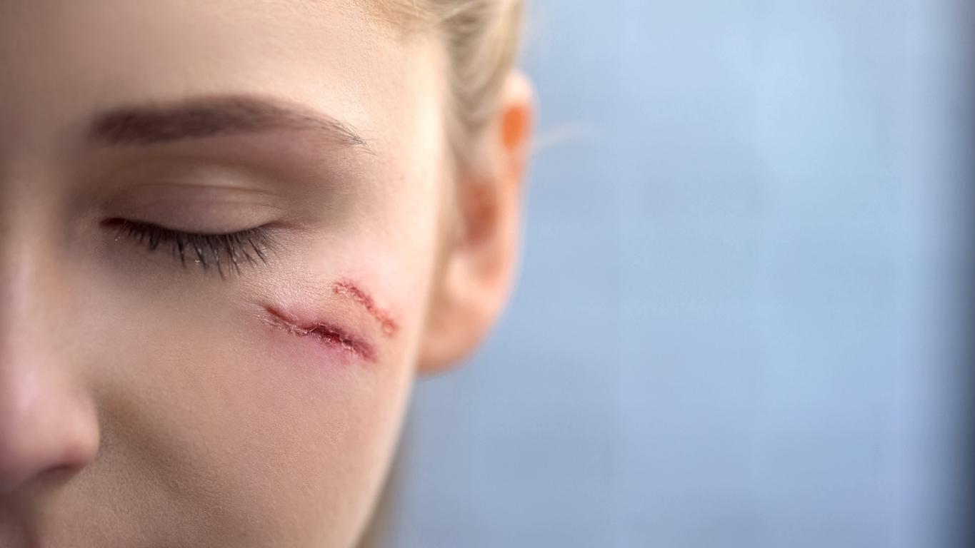 Creative Approaches To Minimizing Scars Safely and Effectively