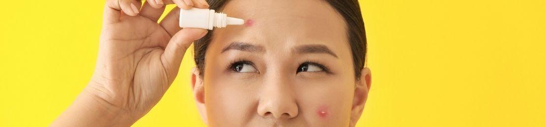 7 Blemish-Banishing Pimple Patches & Spot Treatments that Will Clear Your Skin