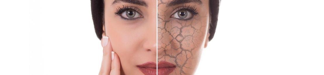 What Is Eczema? Causes, Triggers, and 5 Soothing Products to Try