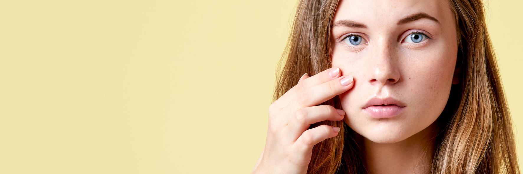 These Ingredients Help Fade Brown Spots Caused By Pimples