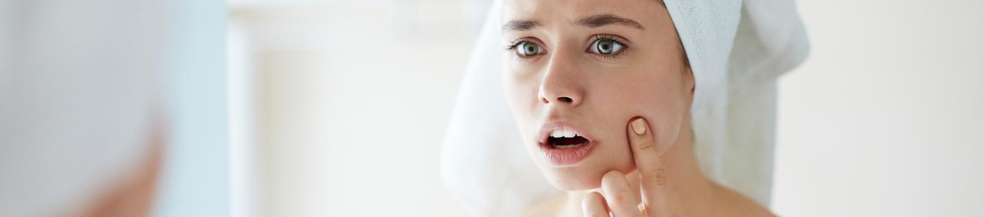 Lessons From the 4 Biggest Skin Mistakes I Made in High School