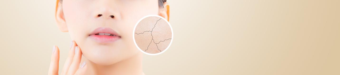 How to Tell Whether You Have Dry Skin or Dehydrated Skin — And Why It Matters