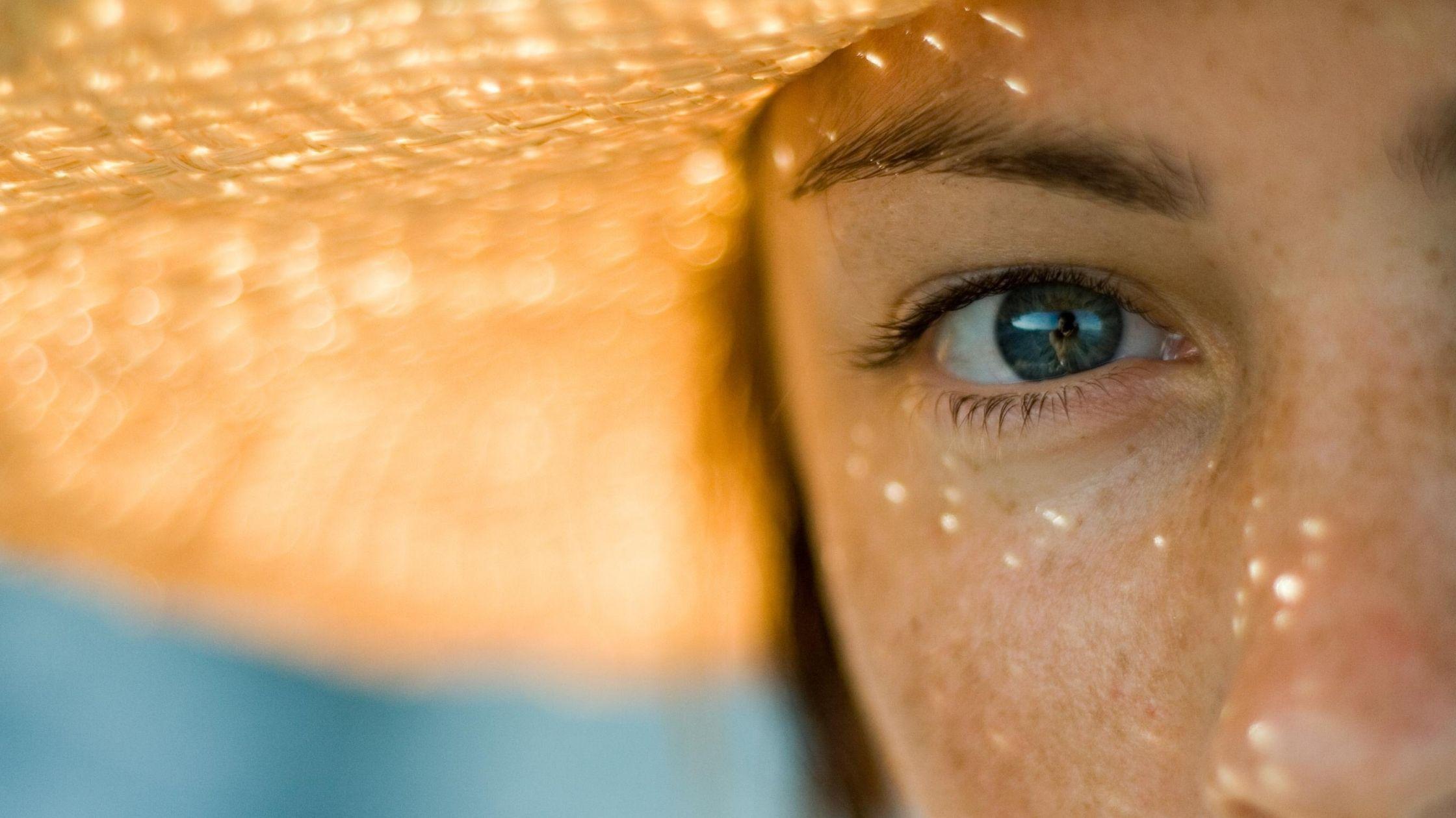 Got Sunspots and Freckles? A Top Dermatologist Explains the Differences and How to Treat Them