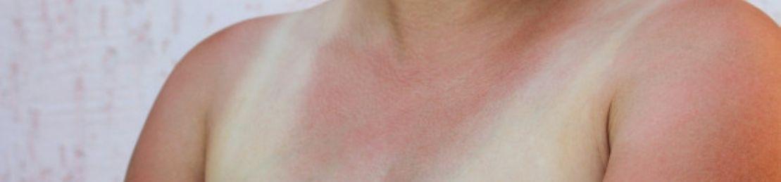 These Doctor-Approved Skin Saviors Will Transform Sun Damaged Skin